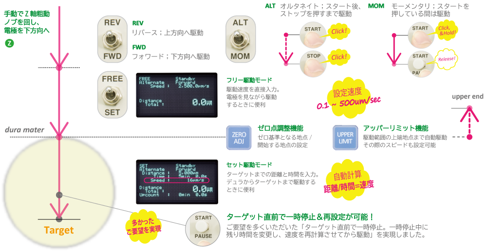 電動セットの機能とそのメリット